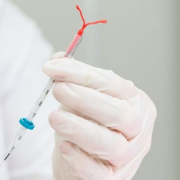 IUD removal em Kelowna / BC