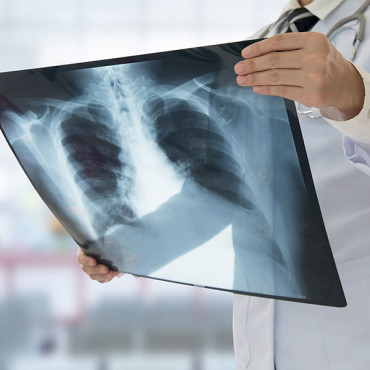 X-ray em Kelowna / BC