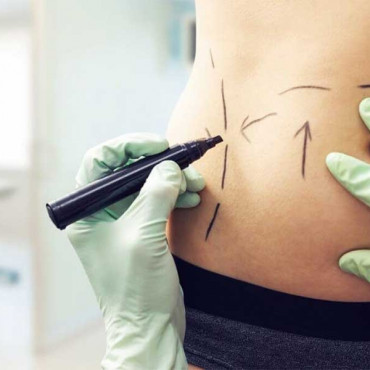 Plastic surgery em Saguenay / QC