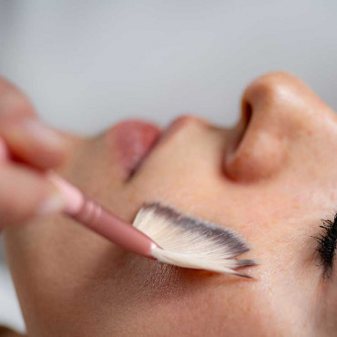Chemical Peel em Kelowna / BC