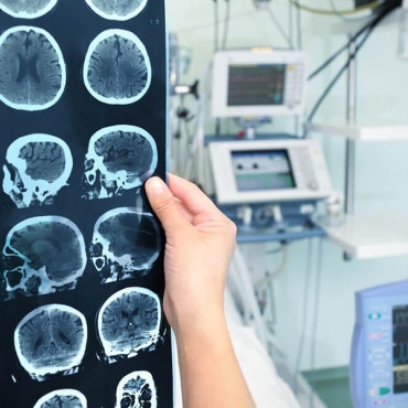 Electroencephalogram em Edmonton / AB