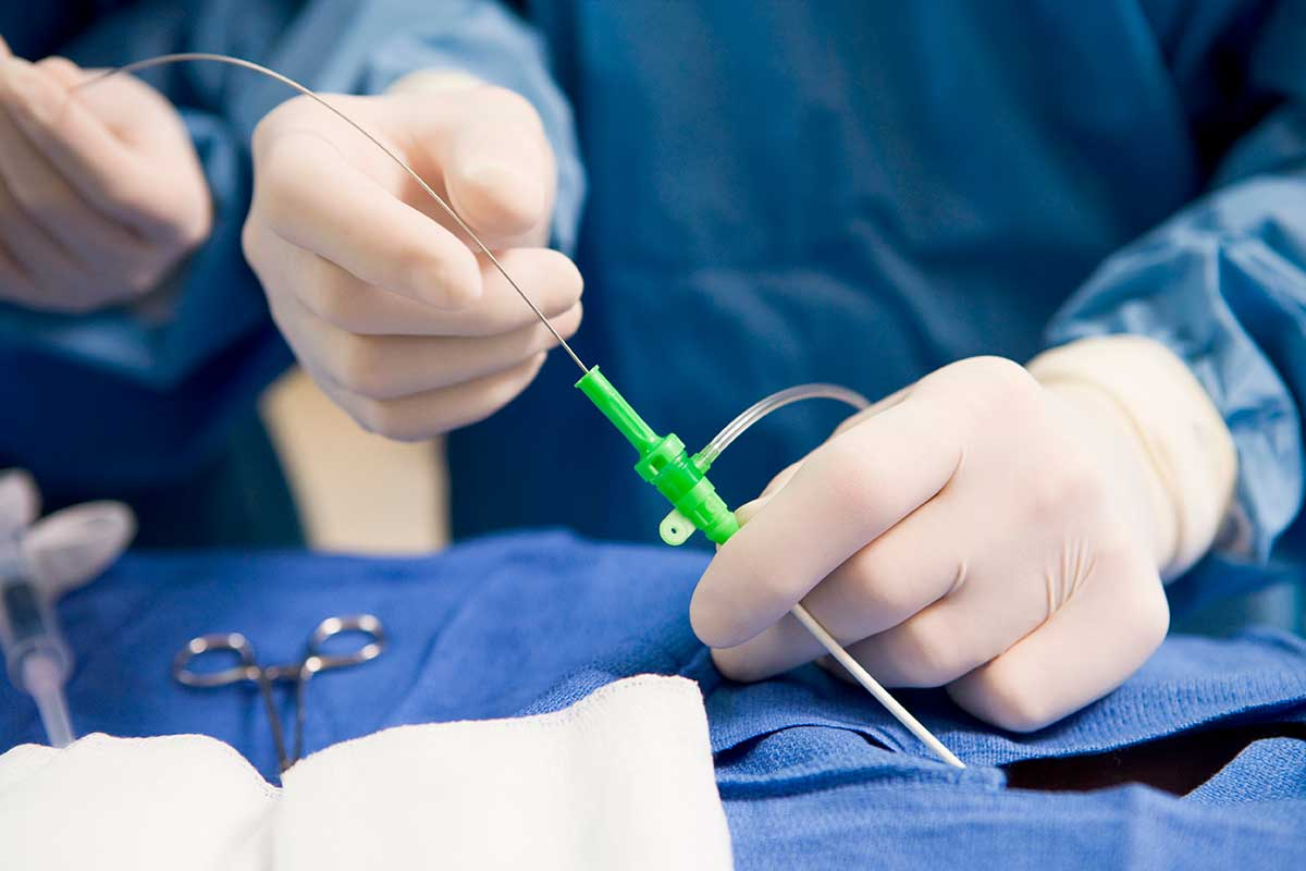Catheterization